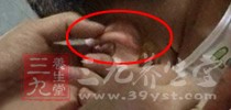 一向把耳大视作有福之相